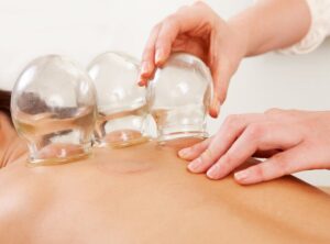 Cupping Therapy in Ayurveda